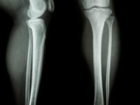 Radiografie ed Ecografie a Domicilio a Roma - Alegiado