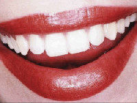 Studio Dentistico Dr. Vincenzo Parziale