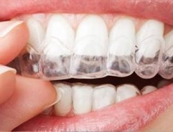 Assenti cinzia - Dentisti medici chirurghi ed odontoiatri - Grottammare (Ascoli Piceno)