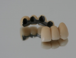 Studio dentistico menoni gianluca - Dentisti medici chirurghi ed odontoiatri - Mori (Trento)
