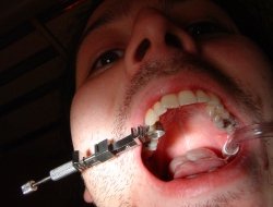 Studio medico odontoiatrico associato - Dentisti medici chirurghi ed odontoiatri - Varzi (Pavia)