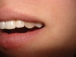 Lana dr. ugo - Dentisti medici chirurghi ed odontoiatri - Piedimulera (Verbano-Cusio-Ossola)