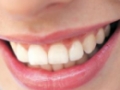 Opinioni degli utenti su Odontoiatra Dr. Paride Bonifazi