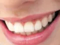 Opinioni degli utenti su Odontoiatra Dr. Paride Bonifazi