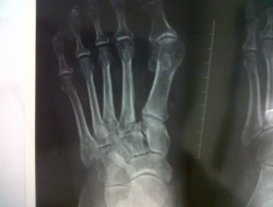 Imago x ray s.r.l. - Radiologia ed ecografia gabinetti e studi - Cerignola (Foggia)